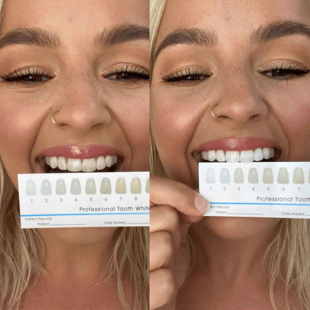 Whitening Pen Pack